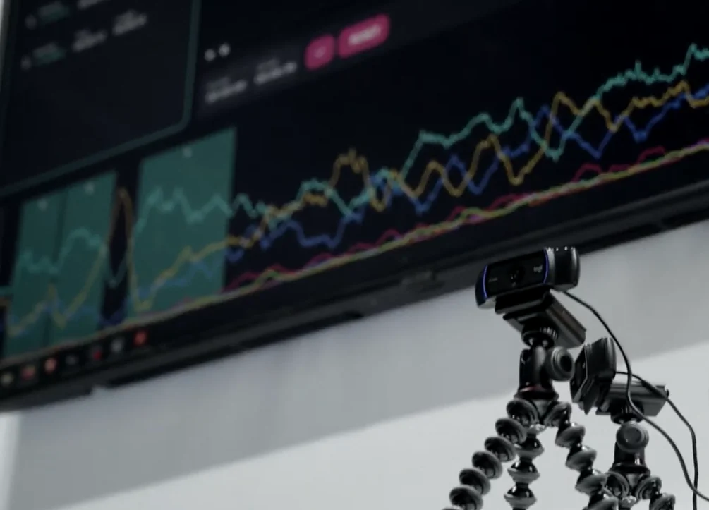 Sensor estándar frente a la pantalla de datos en directo.